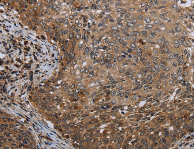 Polyclonal Rabbit anti-Human MT-ND6 Antibody (IHC)