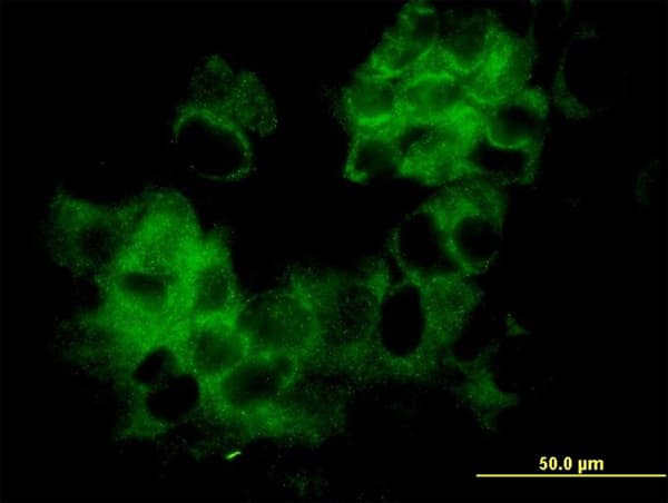 KRT33B / Keratin 33B / KRTHA3B Antibody (clone 4A6-A7)