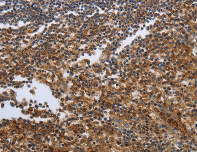 PDCD2 Antibody