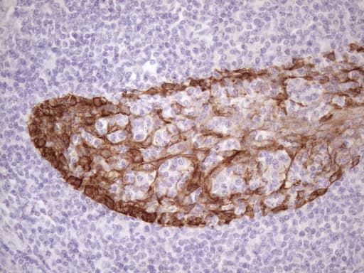 KRT16 / CK16 / Cytokeratin 16 Antibody (clone 7A4, Carrier-free)