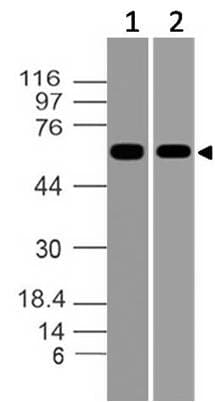 Polyclonal Rabbit anti-Human ASB2 Antibody (WB)