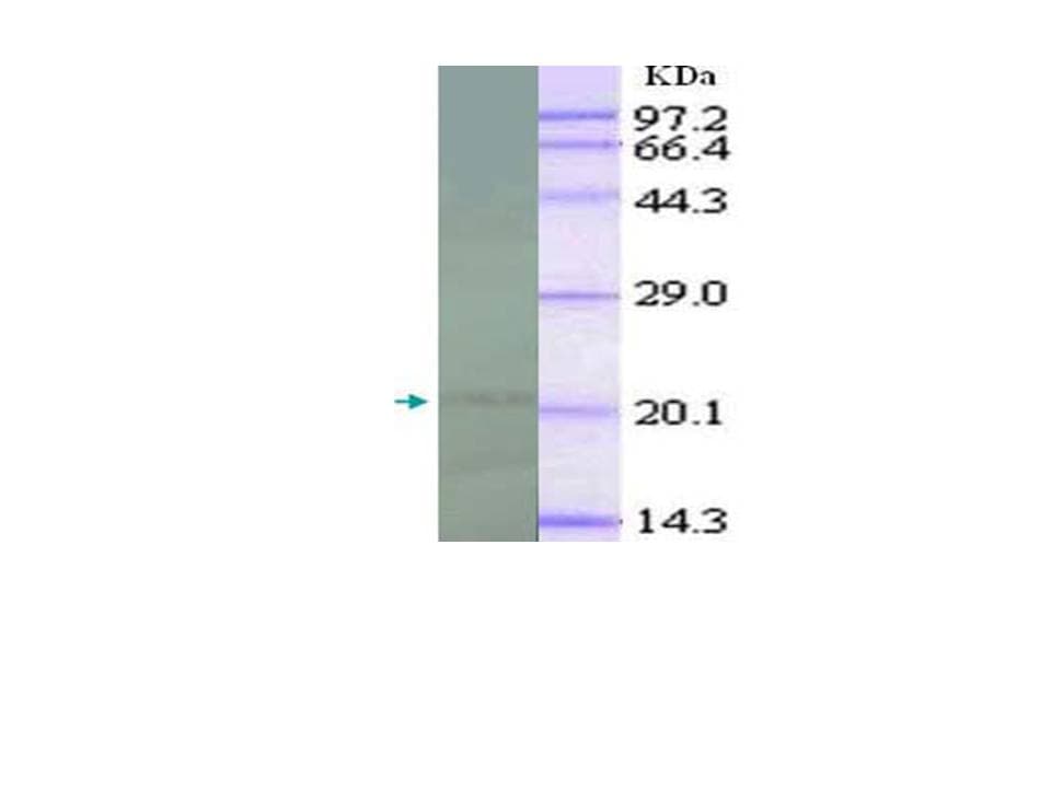 Monoclonal Mouse anti-Human IL18 Antibody (clone 50008-2, IHC, WB)