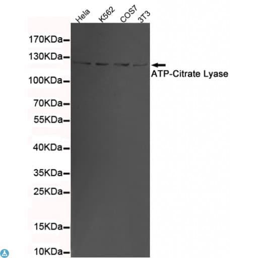 Monoclonal Mouse anti-Human ACLY / ATP Citrate Lyase Antibody (WB)