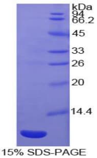 Human CCL20 / MIP-3-Alpha Protein (Recombinant His)