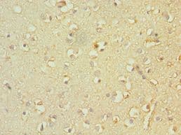 TACR3 / NK3R Antibody (aa356-465)