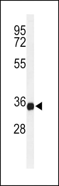 IHC-plus™ Polyclonal Rabbit anti-Human TMEM173 / STING Antibody (aa311-340, IHC, WB)