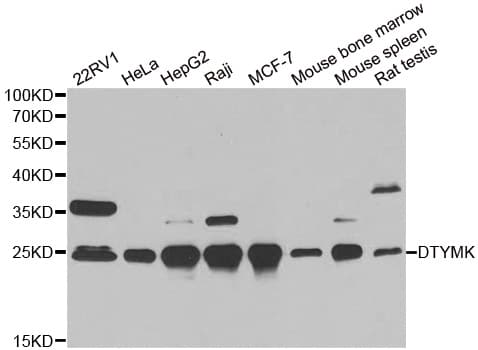 Thymidylate Kinase Antibody