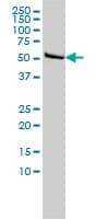 IHC-plus™ Monoclonal Mouse anti-Human DLD / Diaphorase / E3 Antibody (clone 3C1, IHC, WB)