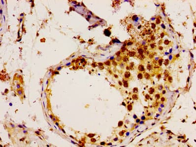 UBE2L3 / UBCH7 Antibody
