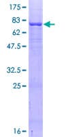 Human EOGT Protein (Recombinant GST)
