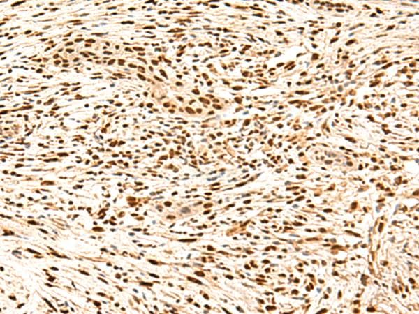 SNRPB2 Antibody