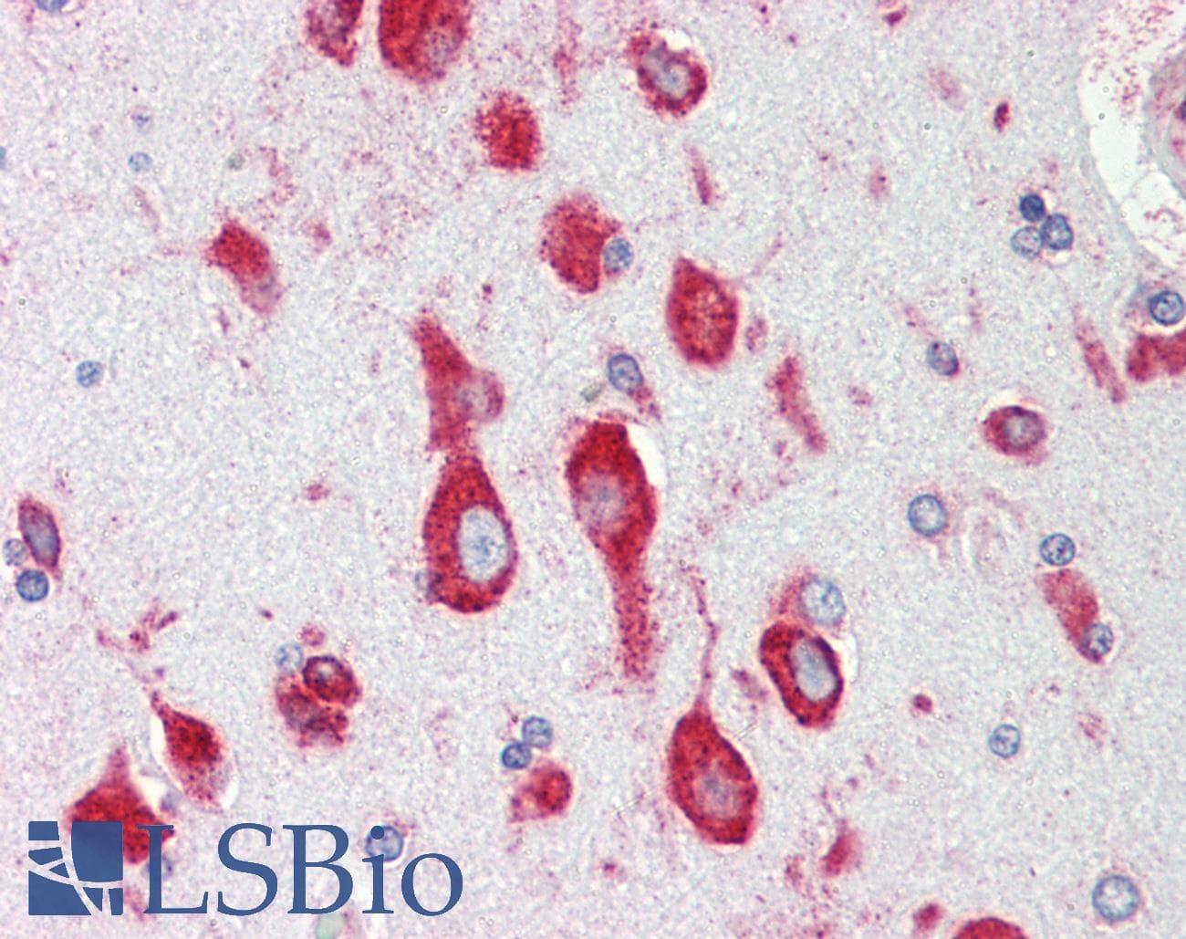 IHC-plus™ RPS12 / Ribosomal Protein S12 Antibody (aa15-44)