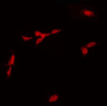 SOX6 Antibody
