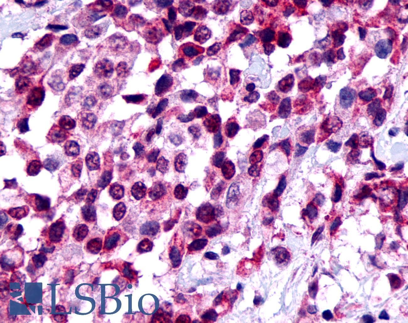 PathPlus™ FZD8 / Frizzled 8 Antibody (N-Terminus)