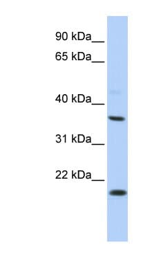 KCNMB3 Antibody (C-Terminus)