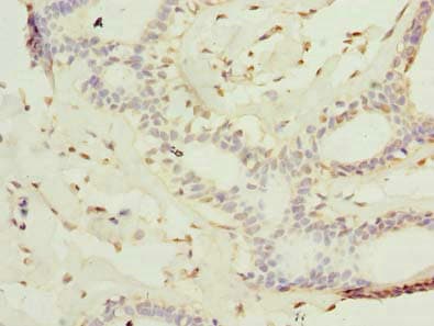 KATNAL2 Antibody
