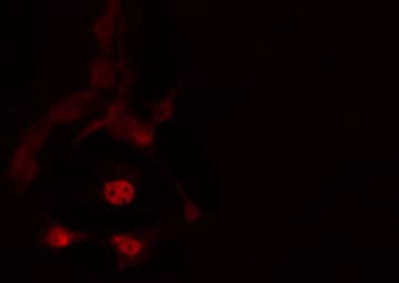 TBX2 Antibody
