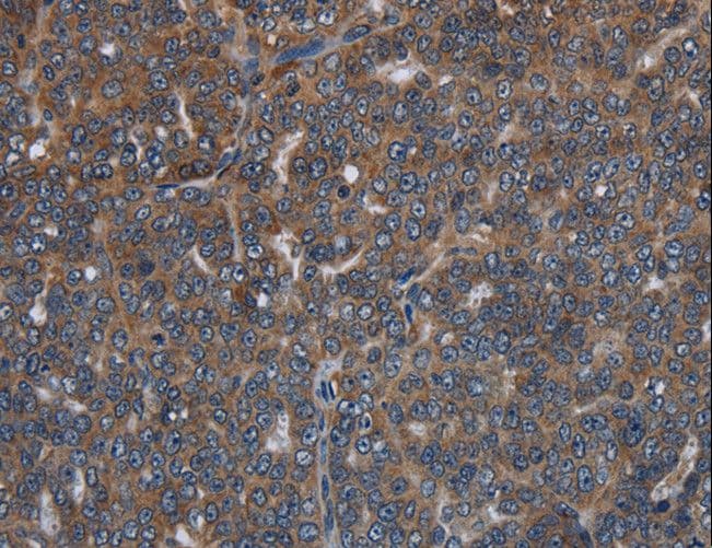 Polyclonal Rabbit anti-Human LETMD1 / HCCR1 Antibody (IHC)