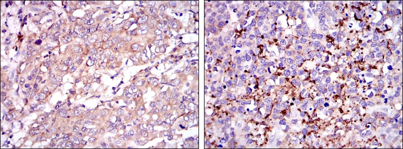 SMN1 Antibody (clone 5H1)