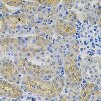 ANGPTL3 Antibody