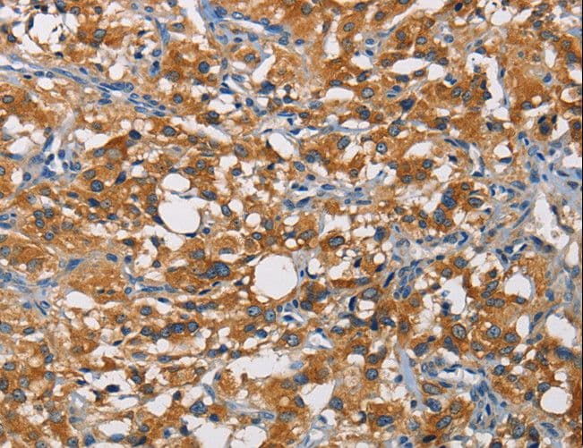 CRTAM Antibody