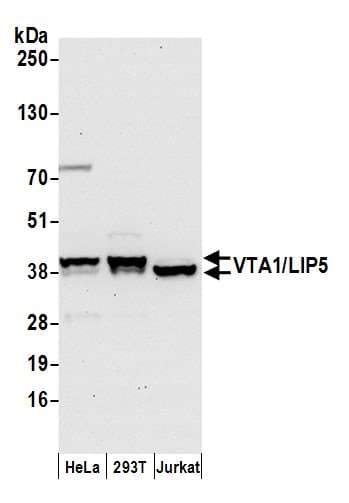 VTA1 Antibody (aa250-300)
