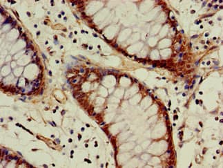 ACAT1 Antibody