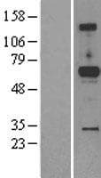 PXYLP1 / ACPL2 Protein (Over-Expression Lysate Myc-DDK (Flag))