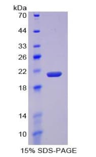 Mouse MMP12 Protein (Recombinant His)