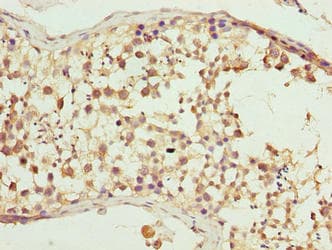 CFAP52 / WDR16 Antibody