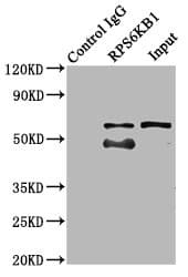 Polyclonal Rabbit anti-Human RPS6KB1 / P70S6K / S6K Antibody (IF)