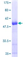 Human PSMD10 / Gankyrin Protein (Recombinant GST)