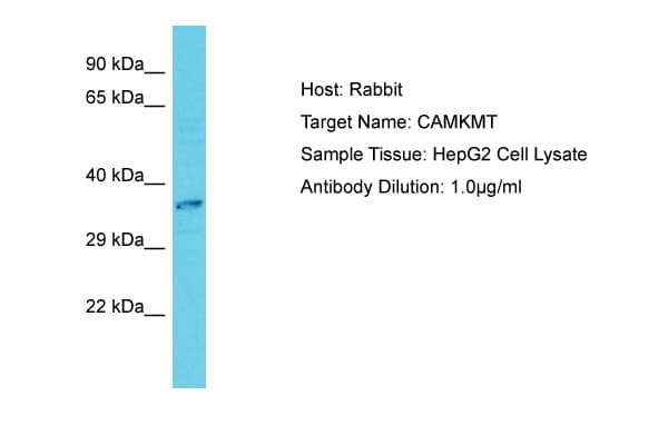 CAMKMT Antibody (C-Terminus)
