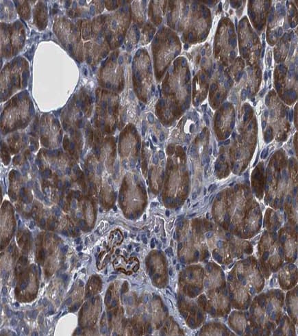 Polyclonal Rabbit anti-Human HRS / HGS Antibody (IHC, IF, WB)