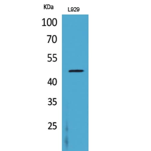 CSF2RA / CD116 Antibody (121-170 aa, Internal)