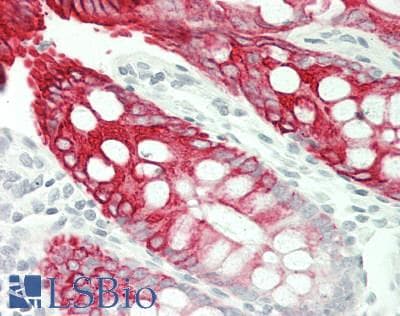 KRT20 / CK20 / Cytokeratin 20 Antibody (clone Ks20.8)