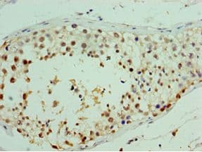 Polyclonal Rabbit anti-Human RDM1 Antibody (aa125-284, IHC)