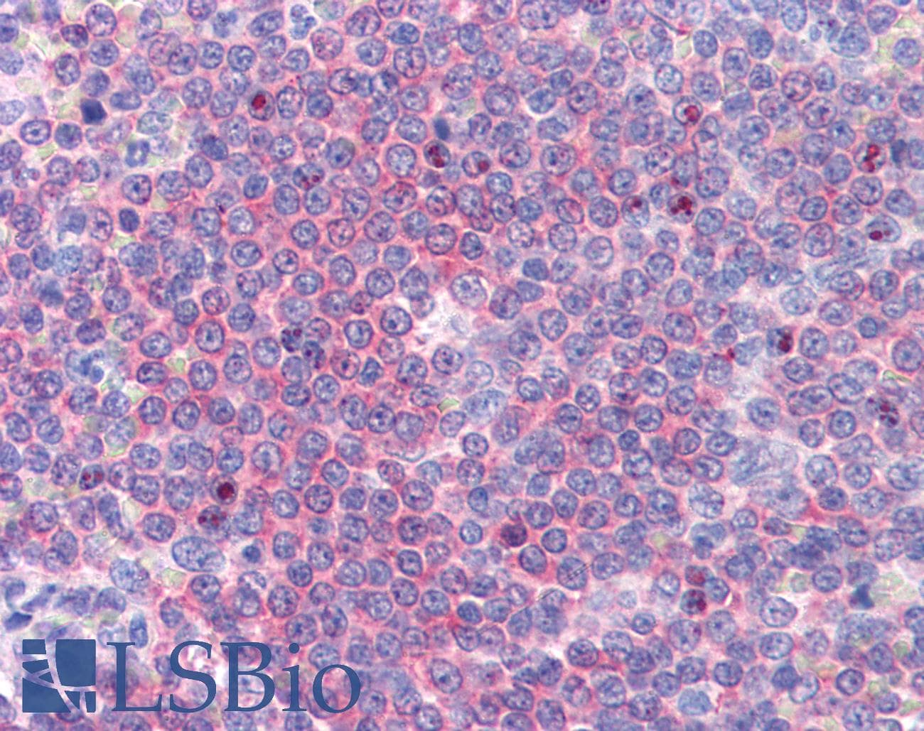IHC-plus™ CNOT4 / CLONE243 Antibody