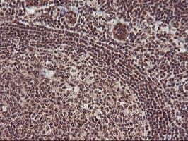 Monoclonal Mouse anti-Human MGLL / Monoacylglycerol Lipase Antibody (clone OTI1B1, IHC, IF, WB)