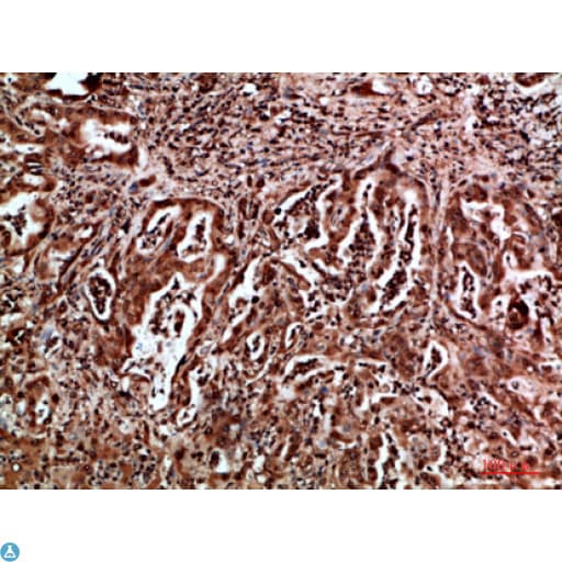 HDGF Antibody
