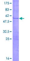Human UNKL Protein (Recombinant GST)