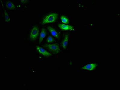 CD95 / FAS Antibody