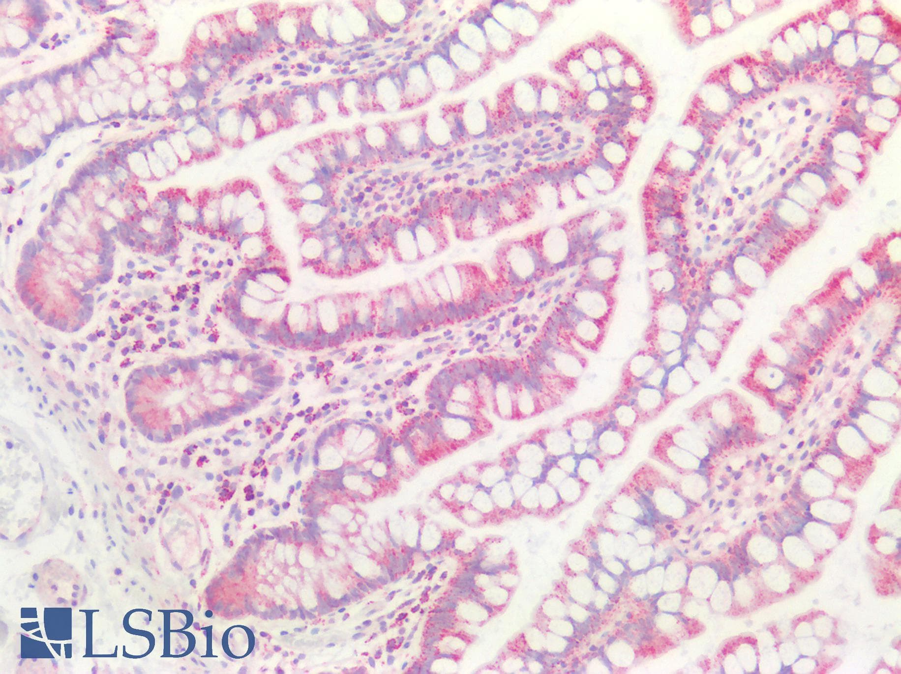 PathPlus™ GLS / Glutaminase Antibody