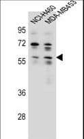 Polyclonal Rabbit anti-Human ANKRD34C Antibody (aa384-412, IHC, WB)