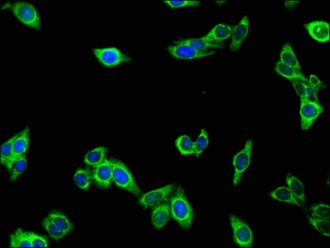 Mannose Phosphate Isomerase Antibody