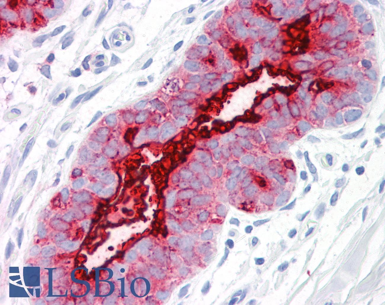 IHC-plus™ EMA / MUC1 Antibody (clone GP1.4)