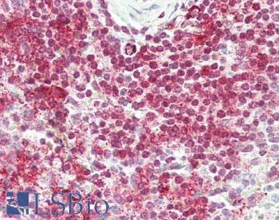 PRMT9 / PRMT10 Antibody (aa795-845)