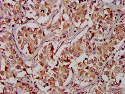 Polyclonal Rabbit anti-Human RICK / RIP2 Antibody (WB)