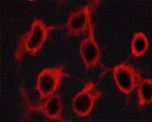Polyclonal Rabbit anti-Human TH / Tyrosine Hydroxylase Antibody (phospho-Ser19, IHC, IF, WB)