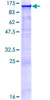 Human KDM1A / LSD1 Protein (Recombinant GST)
